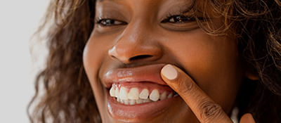 Periodontia.jpg