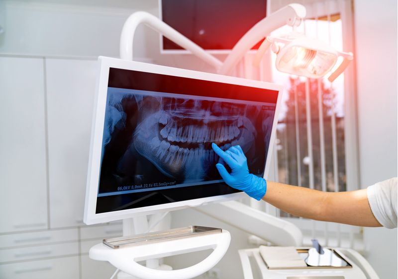 avancado_em_implantodontia_oral.jpg